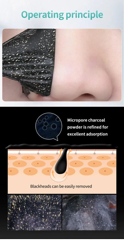 LANBENA Blackhead Removal Mask for Pore Cleansing